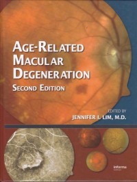 Age-related macular degeneration
