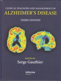 Clinical diagnosis and management of alzheimer's disease