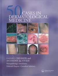 Fifty Cases in Dermatological Medicine