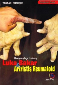 Luka bakar dan artritis reumatoid