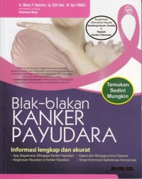 Blak-blakan kanker payudara. Informasi lengkap dan akurat