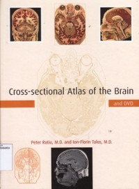 Cross-sectional atlas of the brain