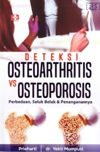 Deteksi osteoarthritis vs osteoporosis: Perbedaan, seluk beluk & penanganannya