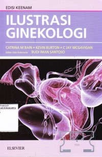 Ilustrasi Ginekologi