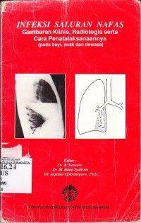 Image of Infeksi Saluran Nafas, Gambaran Klinis Radiologi Serta Cara Penatalaksanaannya (pada Bayi, Anak, dan Dewasa)